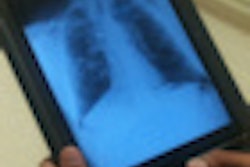 2010 11 29 15 11 21 736 Ipad Tuberculosis 200 Thumb