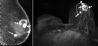 2010 11 29 18 45 31 661 Berg 3and4 450