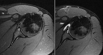 2010 11 30 17 51 18 939 Shoulder Combined 450