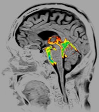 2010 12 01 11 42 46 552 Csf Time Slip I Maging 200