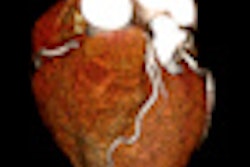 2010 12 01 11 42 47 71 Aquilion One Sub M Sv Prospective Cardiac Cta With Aidr Thumb