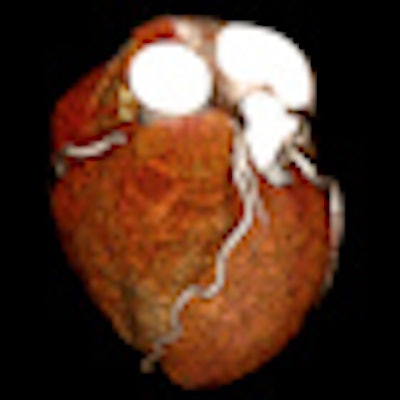 2010 12 01 11 42 47 71 Aquilion One Sub M Sv Prospective Cardiac Cta With Aidr Thumb