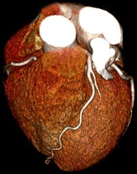 2010 12 01 11 42 48 103 Aquilion One Sub M Sv Prospective Cardiac Cta With Aidr 200