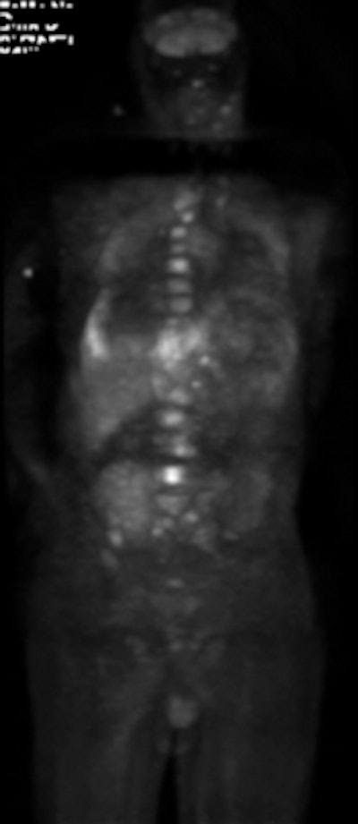 2010 12 01 14 11 22 887 Zahiri Ptld 175