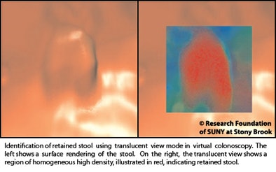 2010 12 06 11 44 48 874 Marino stool