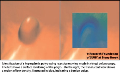 2010 12 06 11 44 51 523 Marino hyperplastic