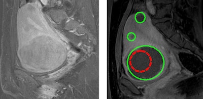 2010 12 07 14 45 59 733 M Vslide 450