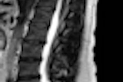 2010 12 08 15 06 43 124 Filippi Slide13 Right Thumb