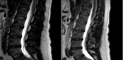 2010 12 08 15 06 47 169 Filippi Slide13 Combined 450