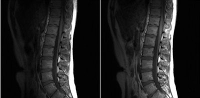 2010 12 08 15 06 50 498 Filippi Slide11 Combined 450