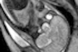 2010 12 09 13 54 03 879 Pregnant Mri Corrected Thumb