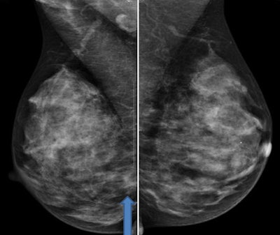 2010 12 13 14 04 40 488 Slide27 Combined 450