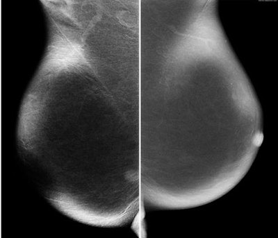 2010 12 13 14 04 42 745 Slide28 Combined 450