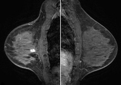 2010 12 13 14 20 21 177 Slide29 Combined 450 V2