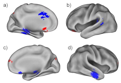 2010 12 16 17 38 24 577 Alzheimers Apoe4 Image 450