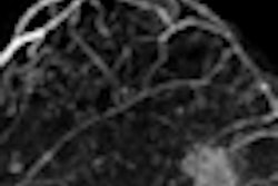 2010 12 21 13 59 53 207 Martincich Mri Breast Thumb