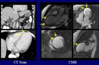 2010 12 28 16 56 03 97 Prosper 52yearold