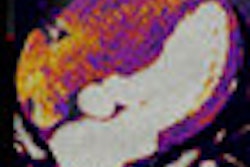 2011 01 03 14 23 37 830 Henzler thumb 01 11 Comp