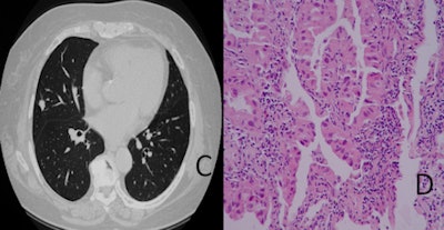 2011 01 05 12 41 03 3 Xu Cad Thoracic Cand D 450