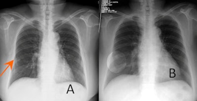 2011 01 05 12 41 05 798 Xu Cad Thoracic Aand B 450