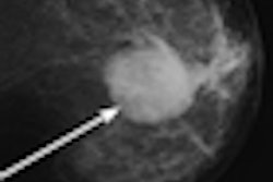 2011 01 05 16 16 55 154 Woods Mammo Fig3 Thumb