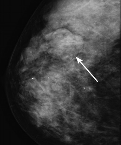 2011 01 05 16 16 58 768 Woods Mammo Fig2 394