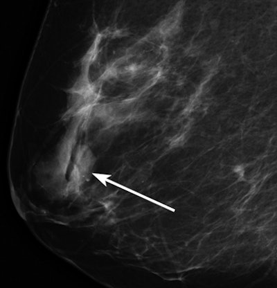 2011 01 05 16 17 00 172 Woods Mammo Fig1 394