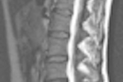 2011 01 06 11 52 01 586 Nelles Spine 01 Thumb