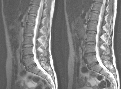 2011 01 06 11 52 02 475 Nelles Spine 01 394