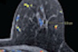 2011 01 11 15 33 02 775 Brinton Breast Slide13 Thumb