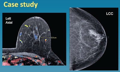 2011 01 11 15 33 04 911 Brinton Breast Slide13 450