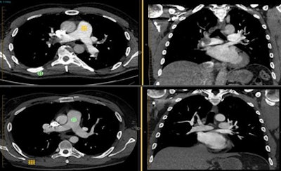 2011 01 13 14 21 39 105 Leipsic patient