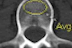 2011 01 19 16 07 38 199 Pickhardt thumb osteo 01 11 V2