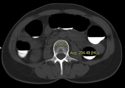 2011 01 19 16 07 42 239 Pickhardt normalbmd top