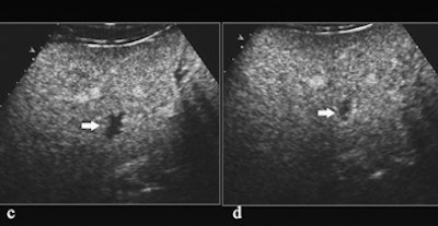 2011 01 24 12 00 43 423 Quaia C And D 394