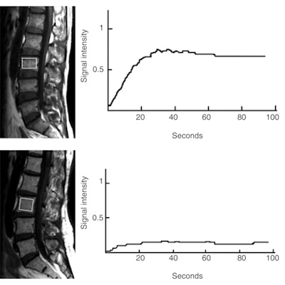 2011 02 01 13 23 17 528 Chen Myeloid Leukemia 450