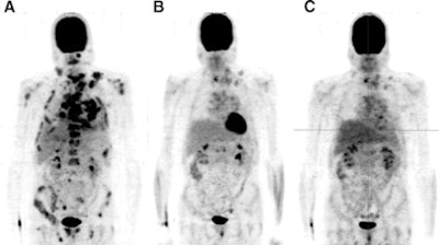 2011 02 01 17 44 54 664 Vandetanib Image 450