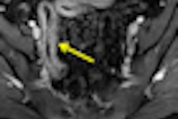 2011 02 04 15 57 21 526 Axial Post Grad Thumb