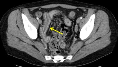 2011 02 04 15 57 23 679 Axial Ct 394