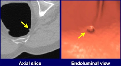 2011 02 09 15 34 02 228 Suzuki Cad Vc 450