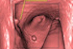 2011 02 10 16 01 31 752 Syngo Via Colon Thumb