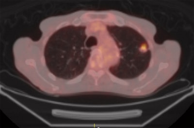 2011 02 15 14 20 37 790 Ohno Fig1e 394