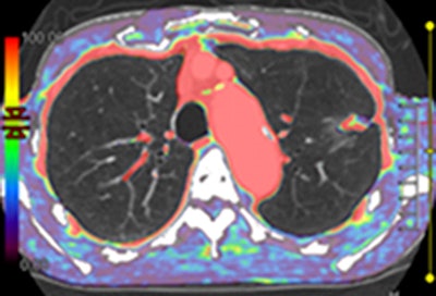 2011 02 15 14 20 39 26 Ohno Fig1b 394