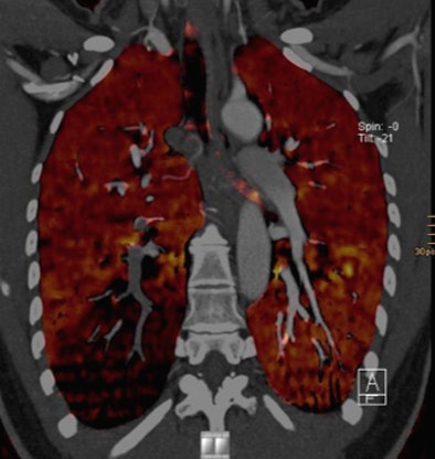 2011 02 17 16 48 46 723 Dezordo bottom