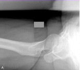 2011 02 18 15 50 09 859 Aaos Images Top 156