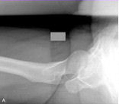 2011 02 18 15 50 09 859 Aaos Images Top 156