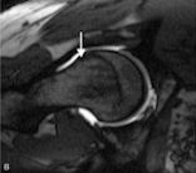 2011 02 18 15 50 10 128 Aaos Images Bottom 156