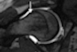 2011 02 18 15 50 10 37 Aaos Images Thumb