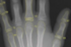 2011 02 25 11 10 10 223 Visiana Thumb