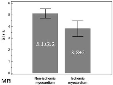 2011 02 22 16 00 43 563 Weininger Upslope Mr 394